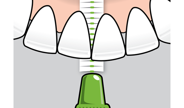 Tepe Method How To Use Tepe