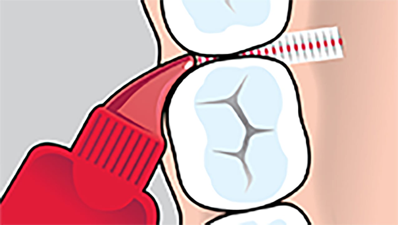 interdentalbuerste-anwendung-backenzahn.jpg