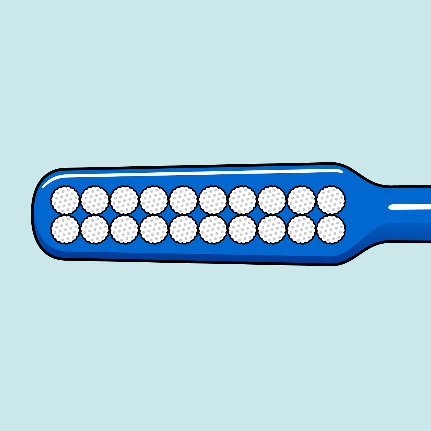 TePe Implantat- / Orthodontiebürste – Extra Schlanker Kopf Für Zahnspangen & Implantate, 1 Stück Grün